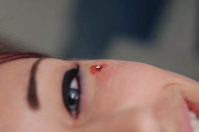 That didn't hurt at all!