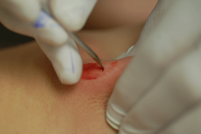 Nice hole!