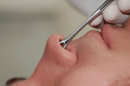 Clamping the nose