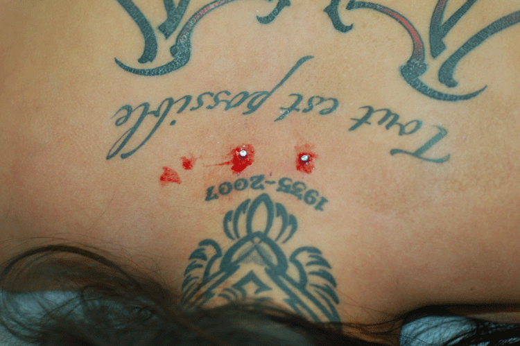 a little blood is nothing to worry about