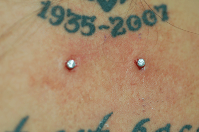 wow that is in perfectly flat against the skin