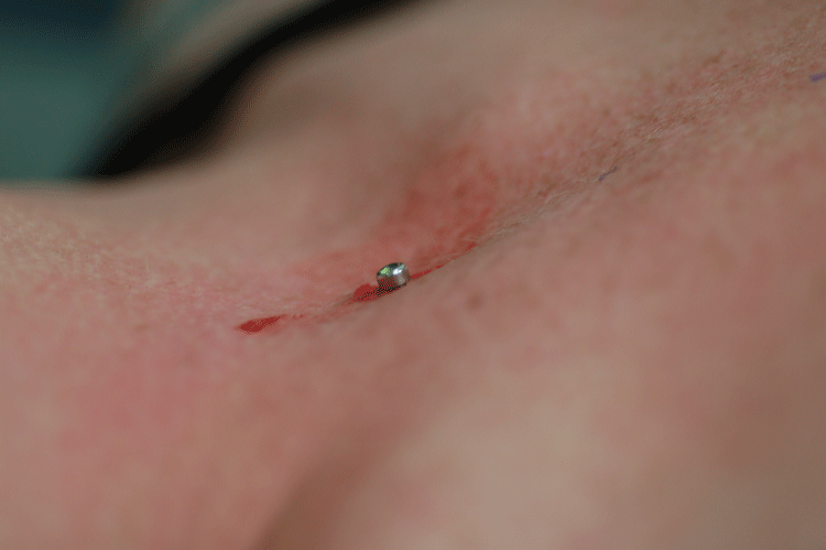 dermals should be flat against the skin and boy this one is!