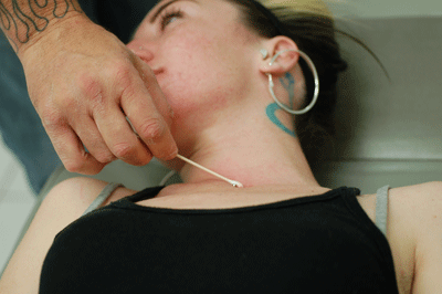 stopping the bleeding