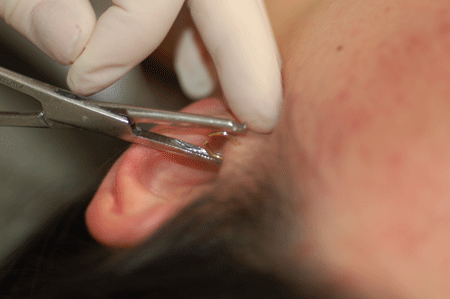 Closing her new captive bead ring