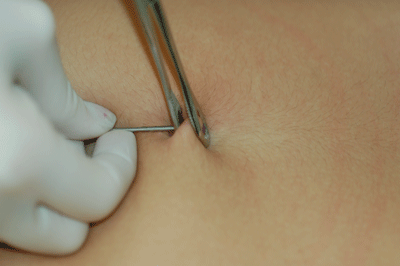 There goes the needle!!