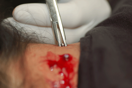Work that dermal in!