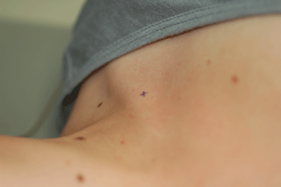 X marks the spot!