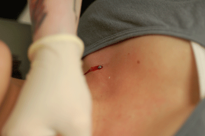 Ah...we are always fond of the bloody shots!