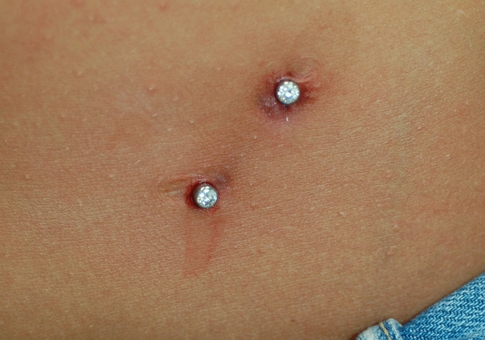 After!