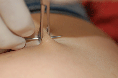 There goes the needle!