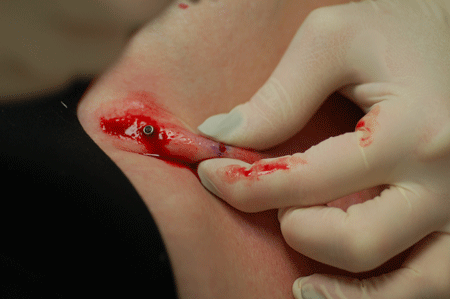 A little blood never hurt anyone