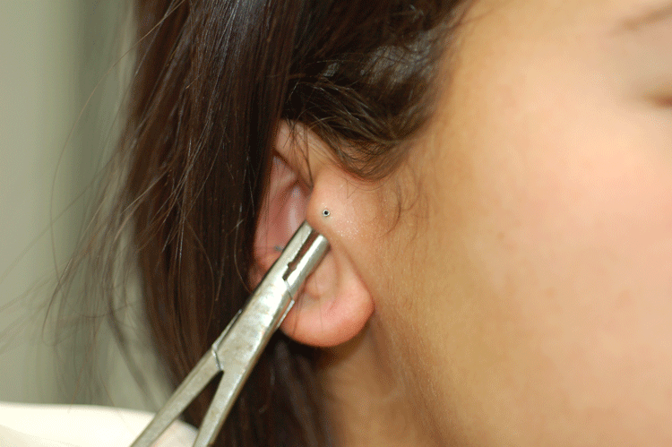 Internally threaded!!! Good choice!