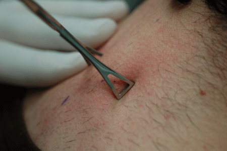 Gotta grab enough skin in order to get that jewelry in