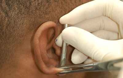 Straighten out that needle!