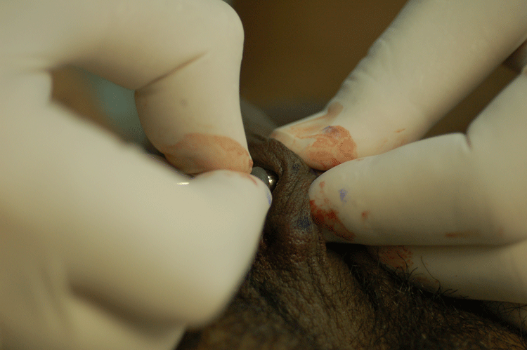 Close up on pushing that bead through